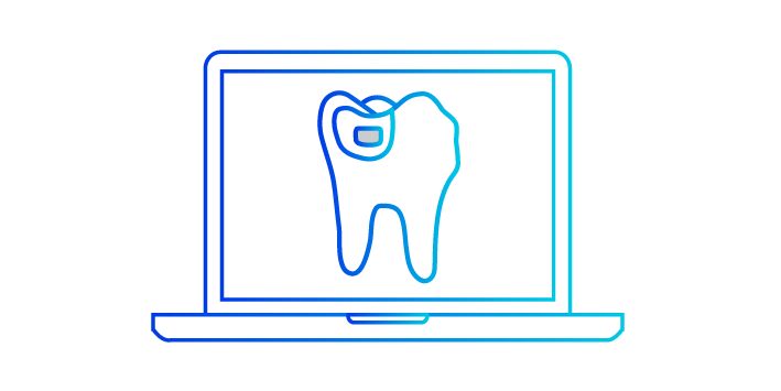 icon of laptop screen with Bioclear tooth prep
