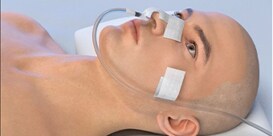 Critical Tube Securement Nasogastric Application video
