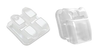 3M Clarity Ceramic brackets
