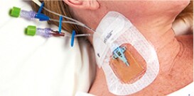 patients neck, bloodstream infections
