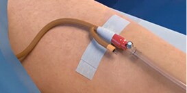 Critical Tube Securement Foley Platform Application video
