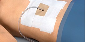 Critical Tube Securement Surgical Drain Application video
